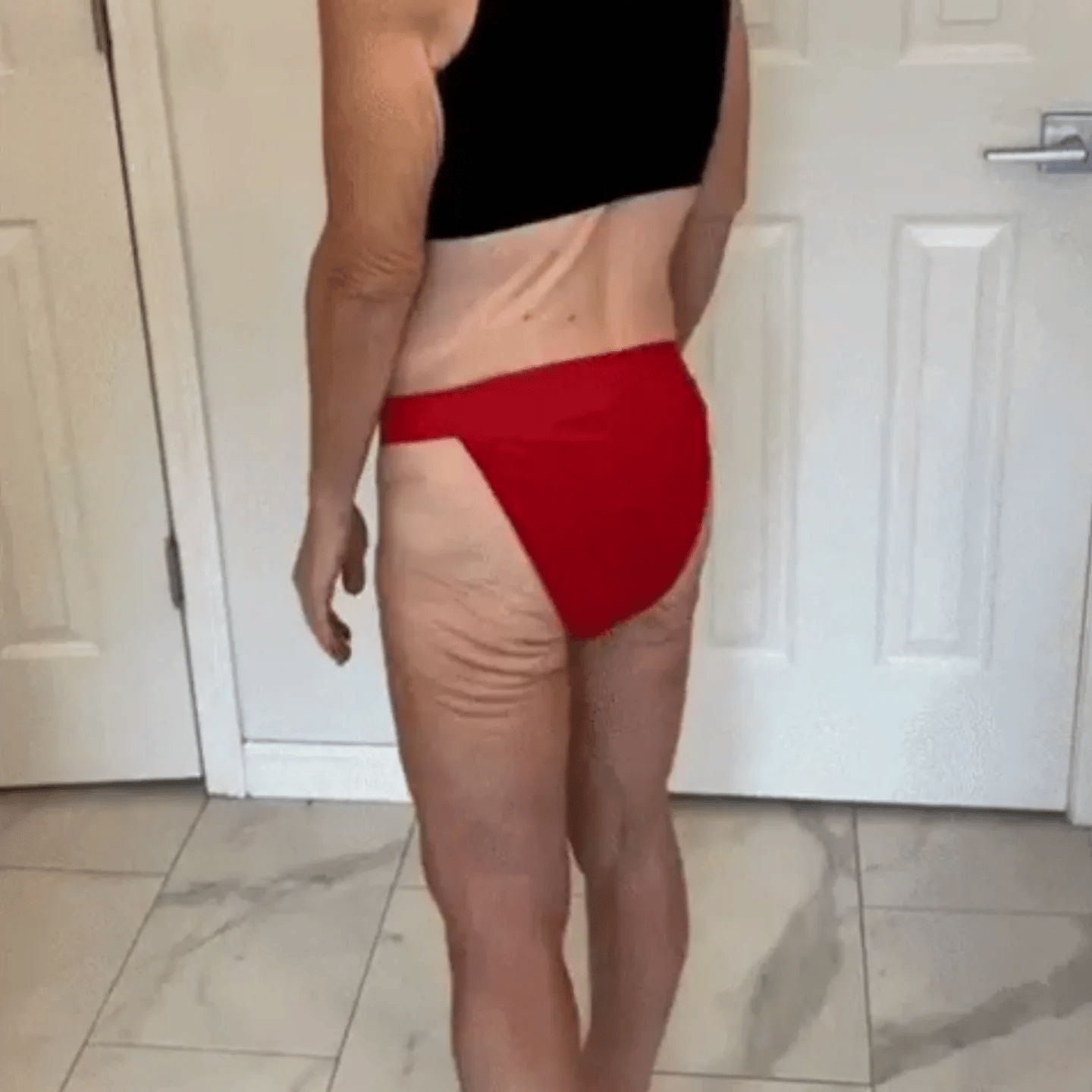 Animated buttocks skin sagging concern