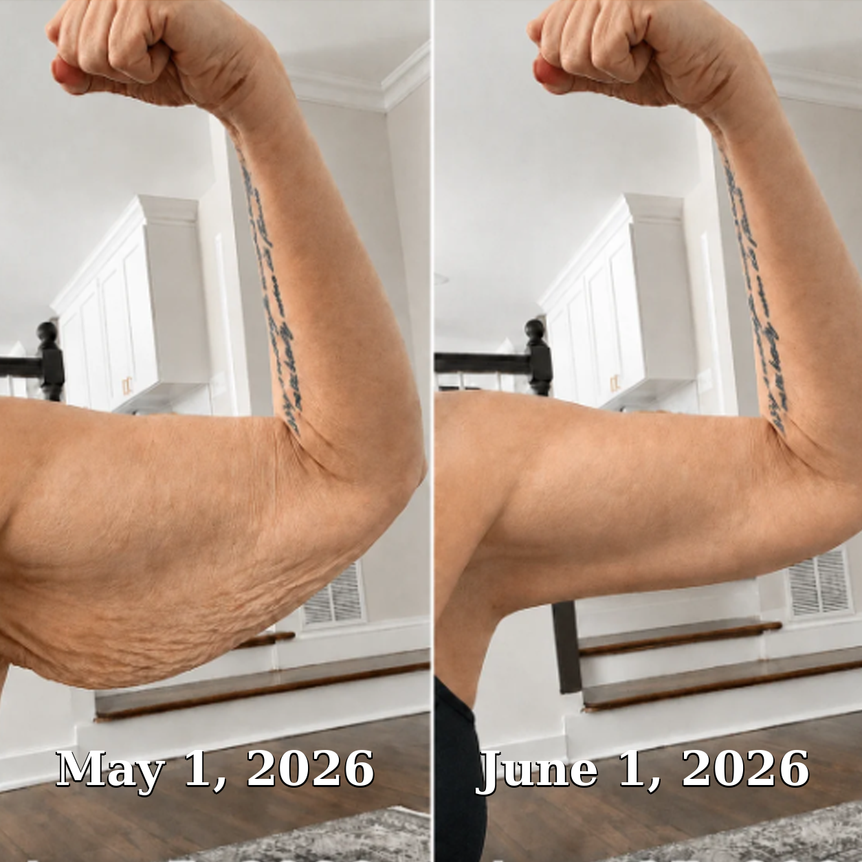 Before and after showing smoother-looking upper arm skin