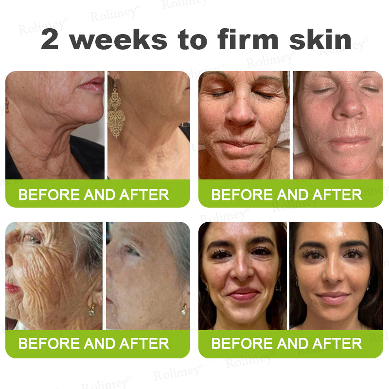 ➡💙💙👨‍⚕️Rolimey®  Vita-A Retinol Shot Wrinkle-Lift Tightening cream