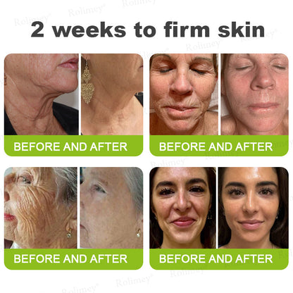 ➡💙💙👨‍⚕️Rolimey®  Vita-A Retinol Shot Wrinkle-Lift Tightening cream
