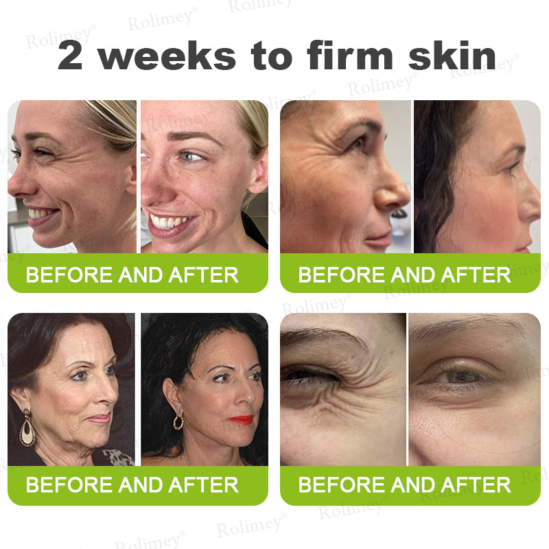 ➡💙💙👨‍⚕️Rolimey®  Vita-A Retinol Shot Wrinkle-Lift Tightening cream