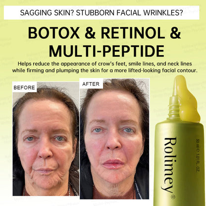 🥇💛Rolimey® Multi-Peptide Retinol Shot Age-Reset Wrinkle-Lift Cream