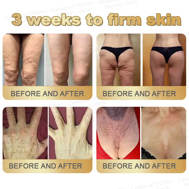 👩‍🔬✨Celsiora® PDRN Multi-Peptide Firming Serum Stick👩‍🔬LAST DAY 70% OFF