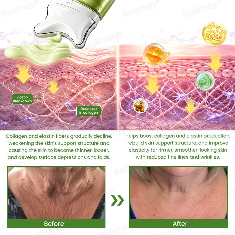 Rolimey® Instant Gua Sha Sculpting Cream(💆‍♀️ Massage, Sculpt & Visibly Lift — From the First Use ⚡)