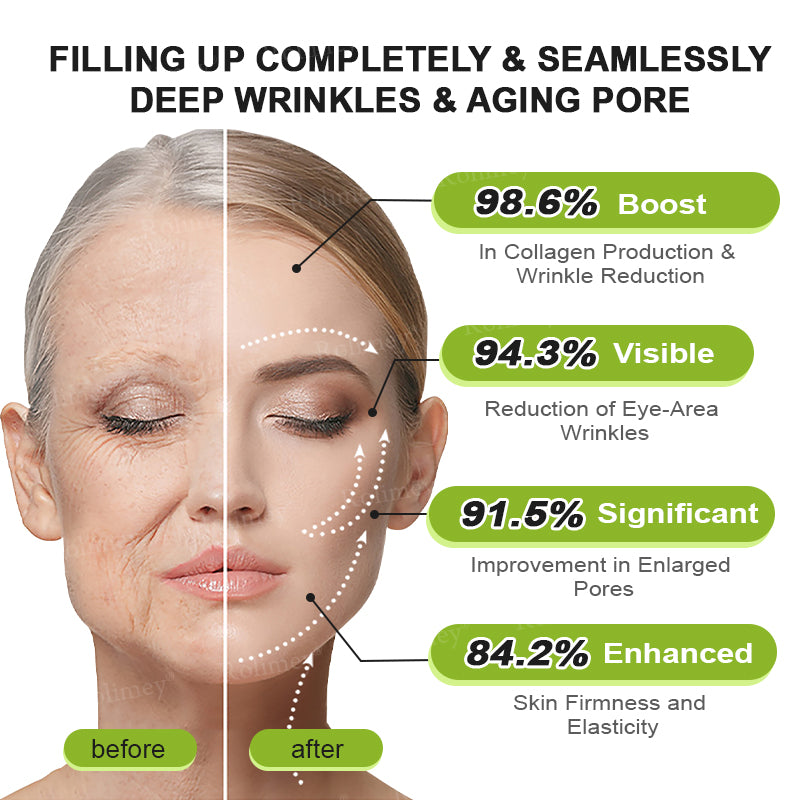 ➡💙💙👨‍⚕️Rolimey®  Vita-A Retinol Shot Wrinkle-Lift Tightening cream