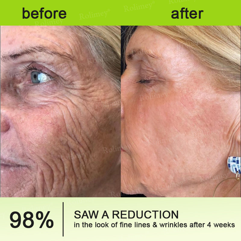 ➡💙💙👨‍⚕️Rolimey®  Vita-A Retinol Shot Wrinkle-Lift Tightening cream