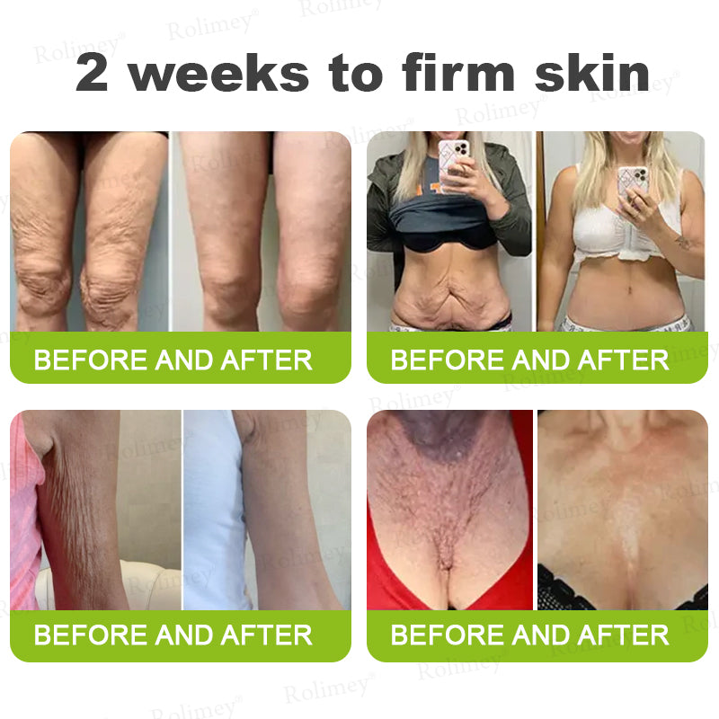 ➡💙💙👨‍⚕️Rolimey®  Vita-A Retinol Shot Wrinkle-Lift Tightening cream