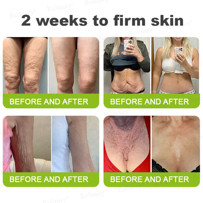 ➡💙💙👨‍⚕️Rolimey®  Vita-A Retinol Shot Wrinkle-Lift Tightening cream