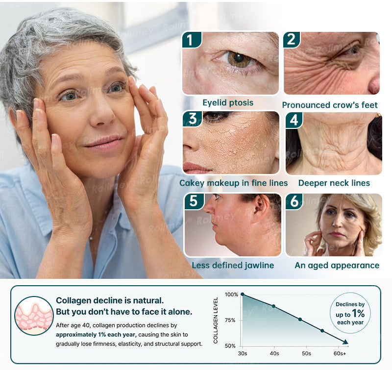 🍃AU HOT SALES ✨Rolimey® Botox & Stem Cell Wrinkle-Lift Tightening Cream