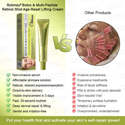 🥇💛Rolimey® Multi-Peptide Retinol Shot Age-Reset Wrinkle-Lift Cream