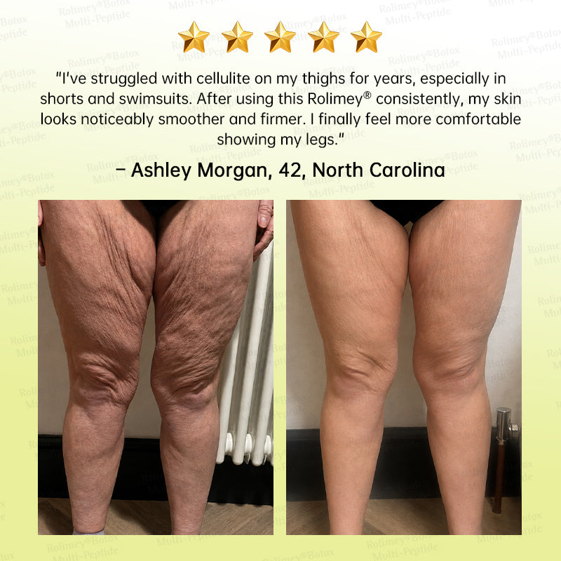 🥇💛Rolimey® Multi-Peptide Retinol Shot Age-Reset Wrinkle-Lift Cream