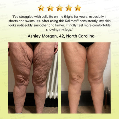 🥇💛Rolimey® Multi-Peptide Retinol Shot Age-Reset Wrinkle-Lift Cream