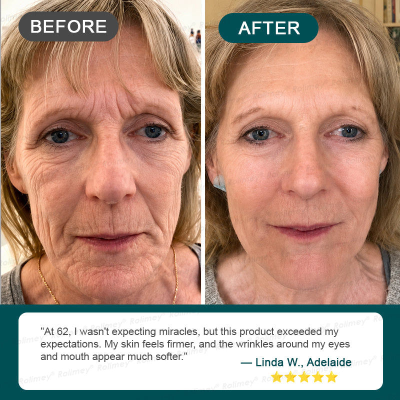 🍃AU HOT SALES ✨Rolimey® Botox & Stem Cell Wrinkle-Lift Tightening Cream