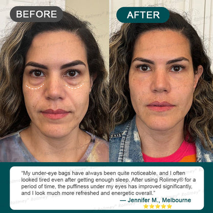 🍃AU HOT SALES ✨Rolimey® Botox & Stem Cell Wrinkle-Lift Tightening Cream