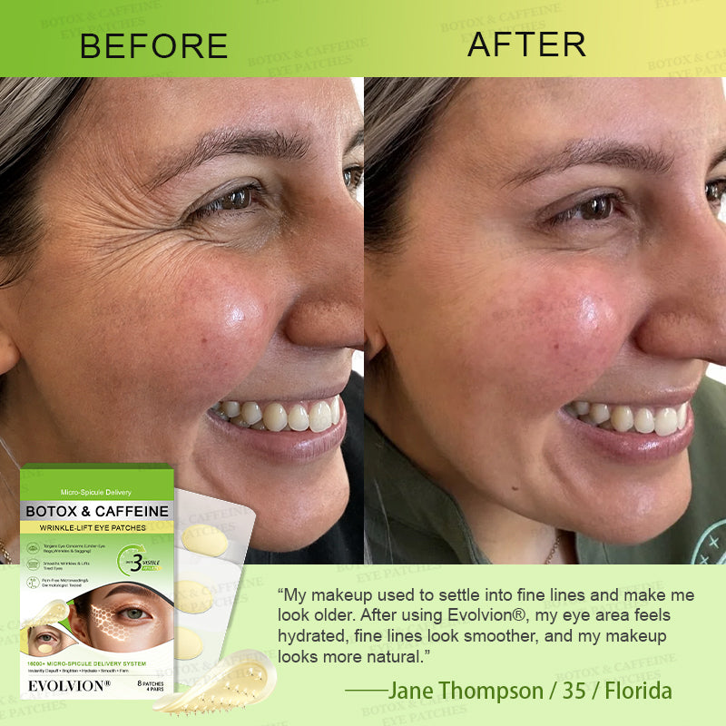 👀🌿AU HOT SALES ✨Evolvion® Botox & Caffeine Wrinkle-Lift Eye Patches