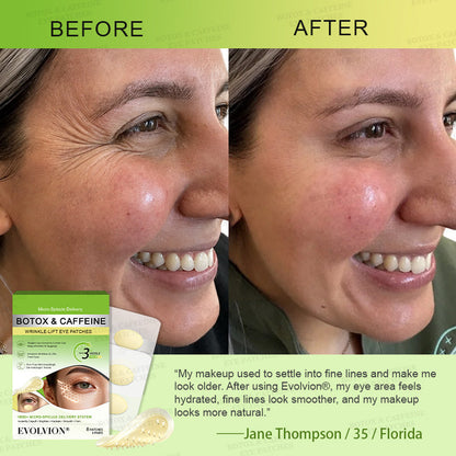👀🌿AU HOT SALES ✨Evolvion® Botox & Caffeine Wrinkle-Lift Eye Patches