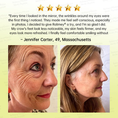🥇💛Rolimey® Multi-Peptide Retinol Shot Age-Reset Wrinkle-Lift Cream