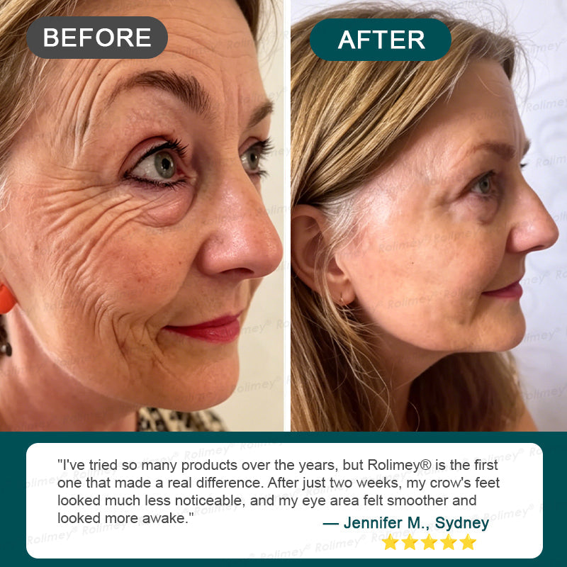 🍃AU HOT SALES ✨Rolimey® Botox & Stem Cell Wrinkle-Lift Tightening Cream
