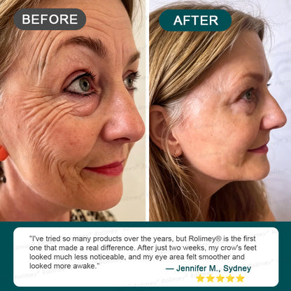 🍃AU HOT SALES ✨Rolimey® Botox & Stem Cell Wrinkle-Lift Tightening Cream