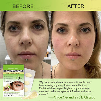 👀🌿AU HOT SALES ✨Evolvion® Botox & Caffeine Wrinkle-Lift Eye Patches