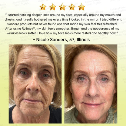 🥇💛Rolimey® Multi-Peptide Retinol Shot Age-Reset Wrinkle-Lift Cream