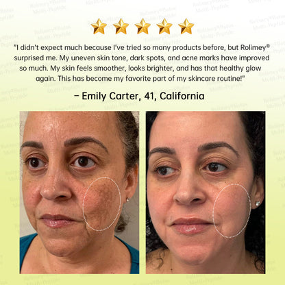 🥇💛Rolimey® Multi-Peptide Retinol Shot Age-Reset Wrinkle-Lift Cream