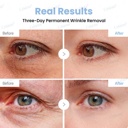 🥈🍃Celsiora® Botox & PDRN Anti-Wrinkle Shot – Lift & Firming Cream