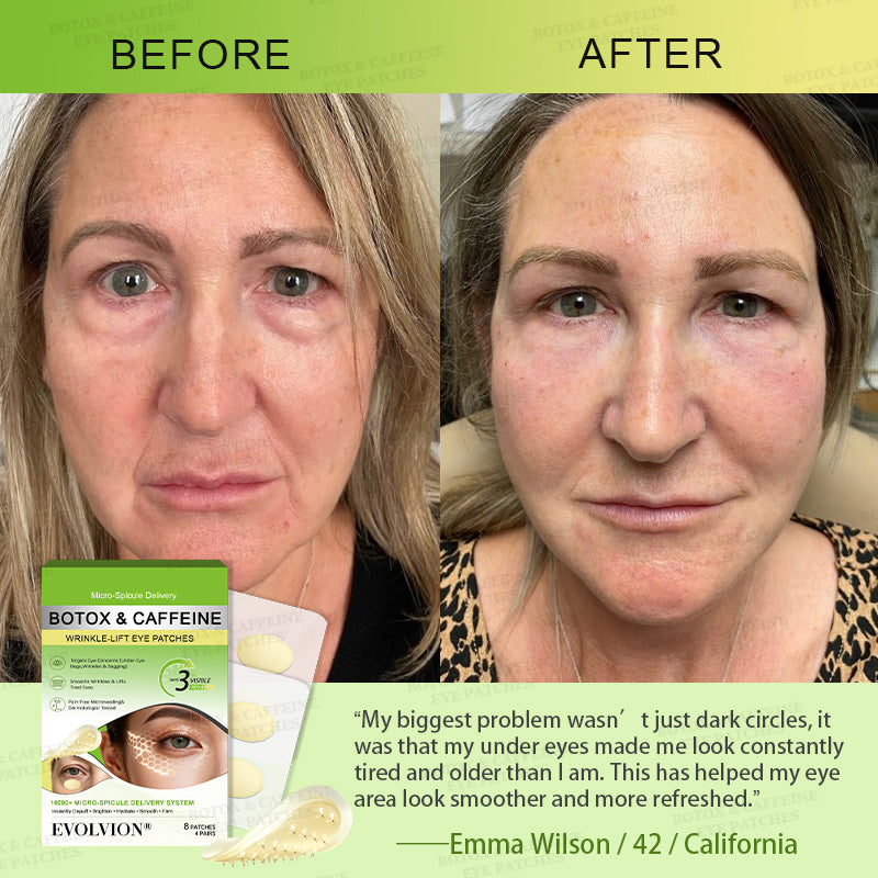 👀🌿AU HOT SALES ✨Evolvion® Botox & Caffeine Wrinkle-Lift Eye Patches