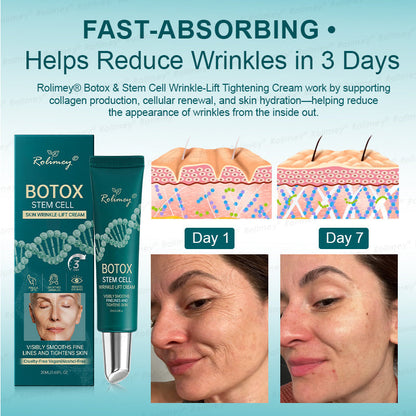 🍃AU HOT SALES ✨Rolimey® Botox & Stem Cell Wrinkle-Lift Tightening Cream