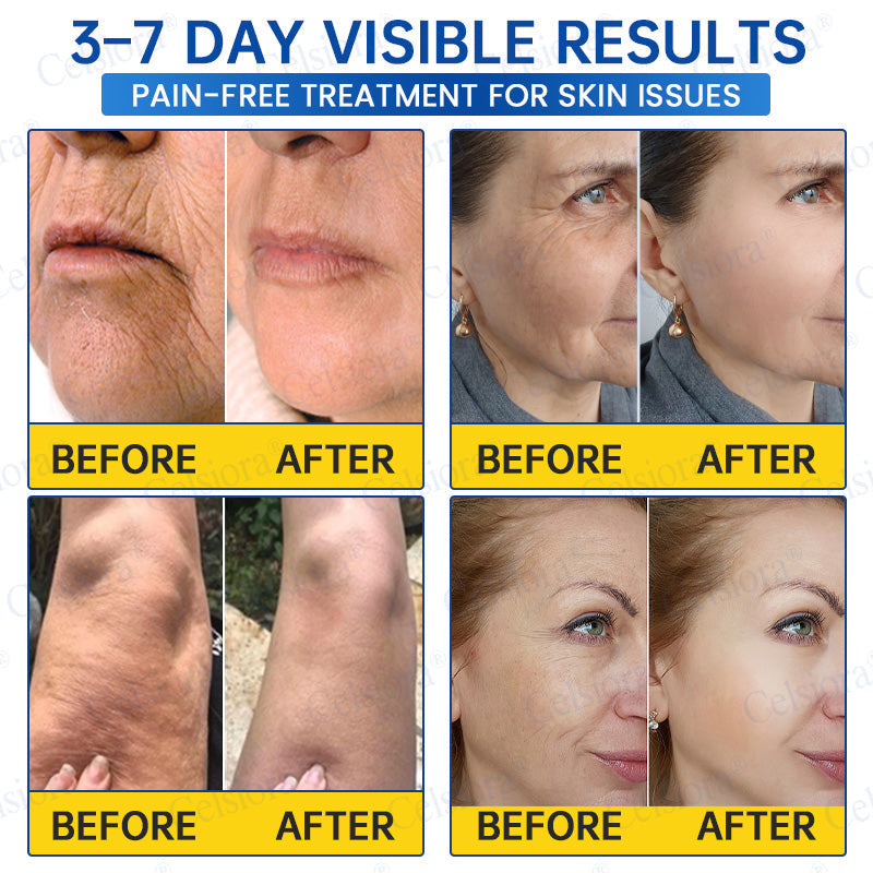 🥈🍃Celsiora® Botox & PDRN Anti-Wrinkle Shot – Lift & Firming Cream