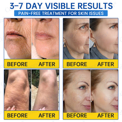 🥈🍃Celsiora® Botox & PDRN Anti-Wrinkle Shot – Lift & Firming Cream