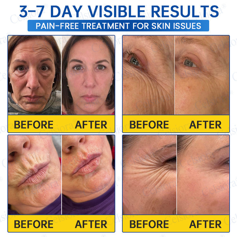 💙🥽Celsiora®  PDRN Anti-Wrinkle Shot – Lift & Firming Cream