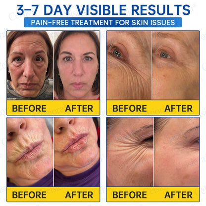 💙🥽Celsiora®  PDRN Anti-Wrinkle Shot – Lift & Firming Cream