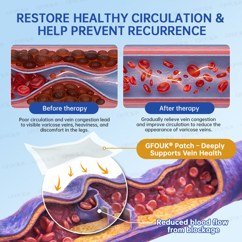 ✅GFOUK® VeinRelief Microneedle Patch ⚡Instant Relief
