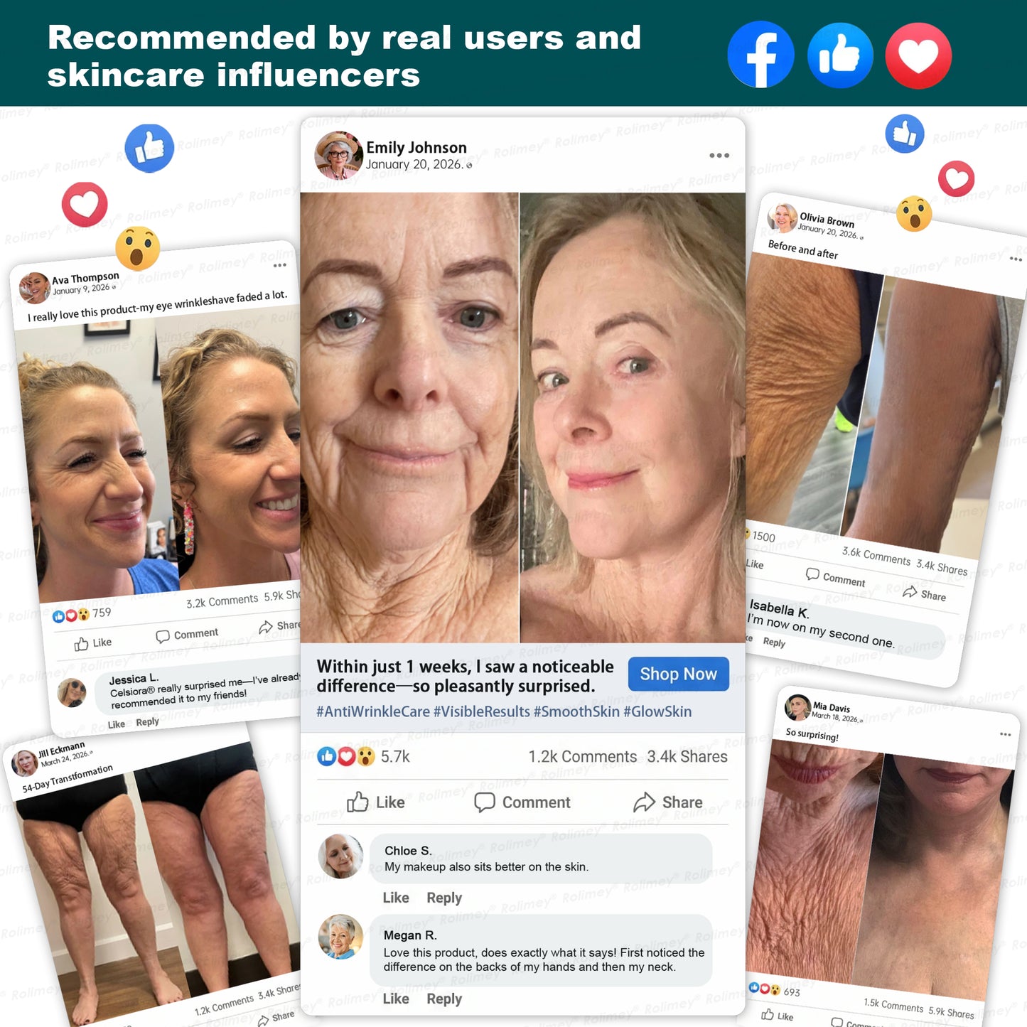 🍃🍃🛒AU HOT SALES ✨Rolimey® Botox & Stem Cell Wrinkle-Lift Tightening Cream