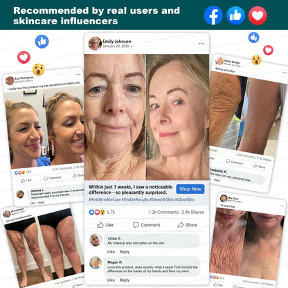 🍃🍃🛒AU HOT SALES ✨Rolimey® Botox & Stem Cell Wrinkle-Lift Tightening Cream
