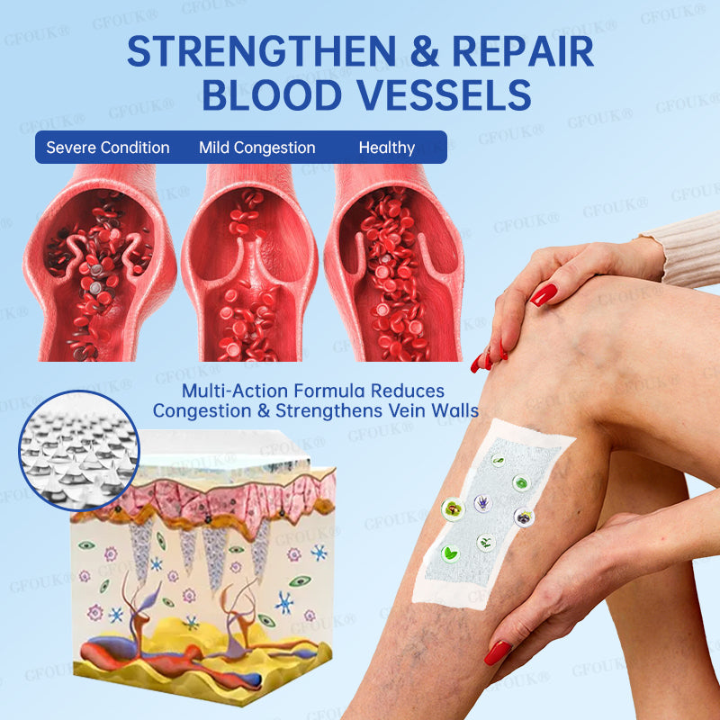 ✅GFOUK® VeinRelief Microneedle Patch ⚡Instant Relief